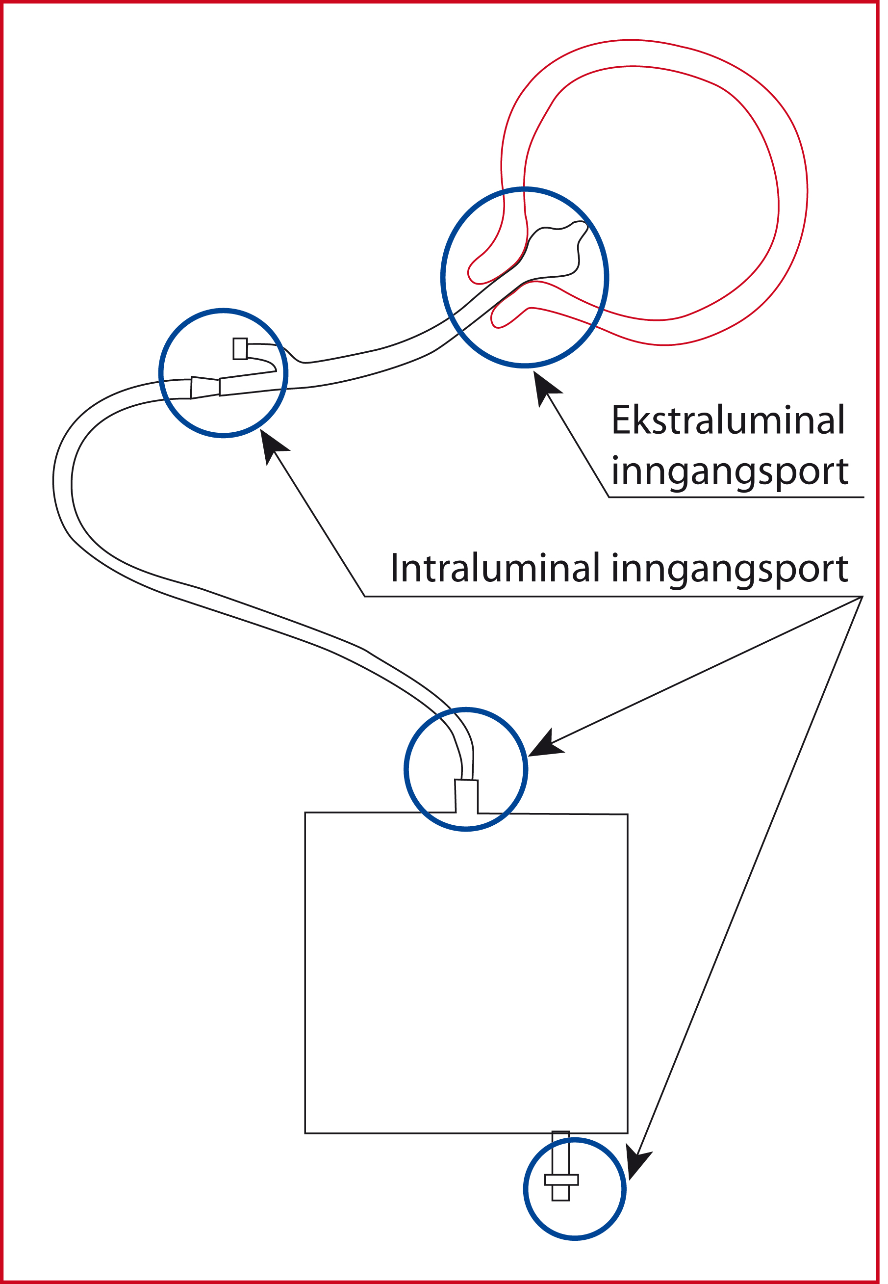 Illustrasjon av kateter med sirkler rundt inngangsportene